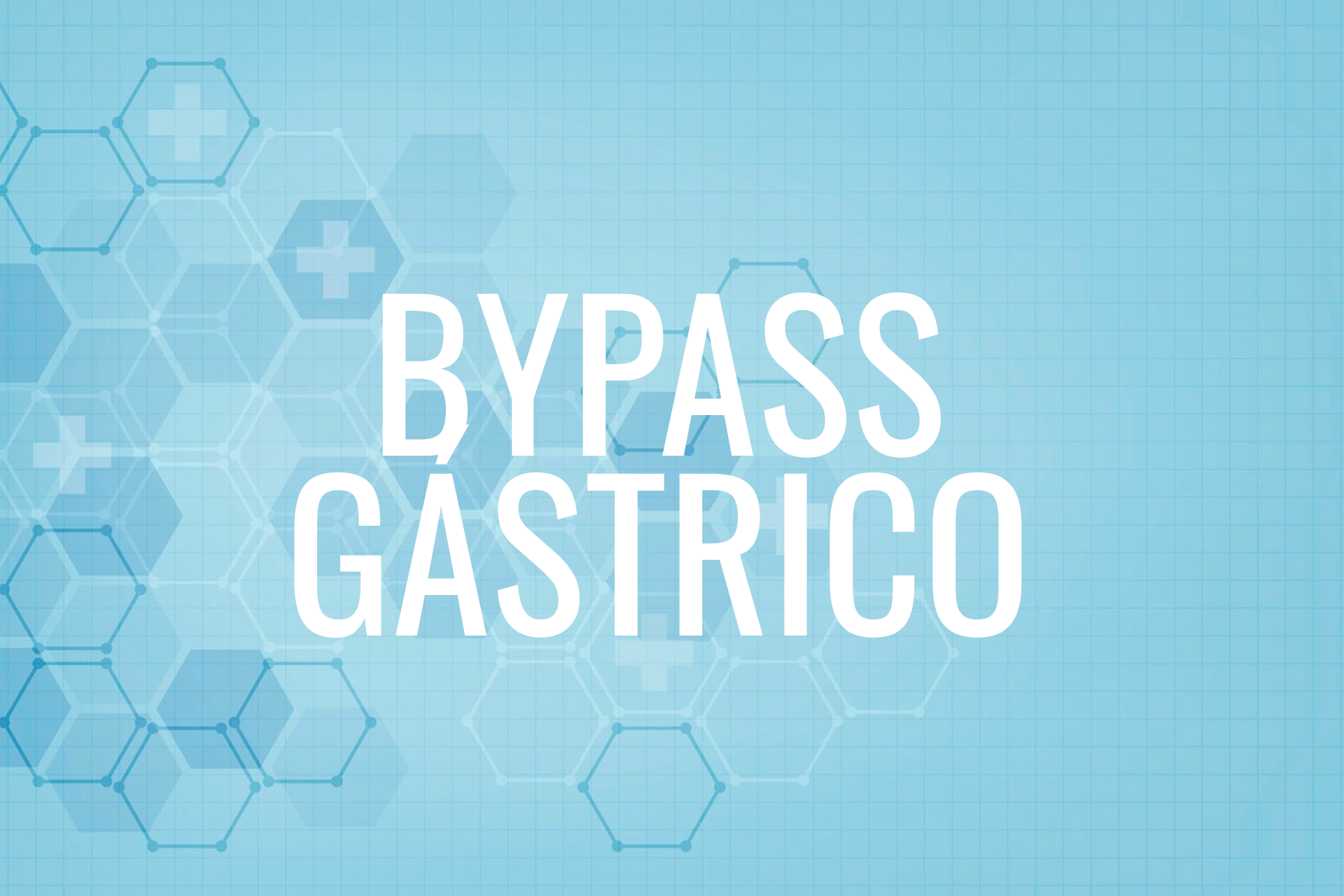 Bypass Gástrico